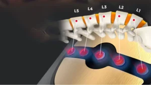 Lumbar Traction Device